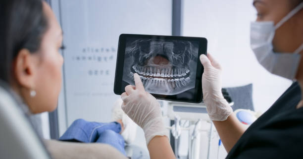 Licensed Dental Implants service in La Crosse, KS - Smile Center Dentistry