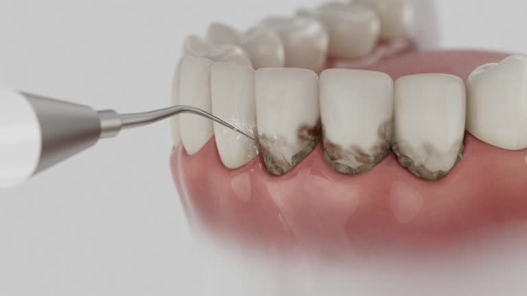 Reliable Dental Implants contractor in La Crosse, KS by Smile Center Dentistry